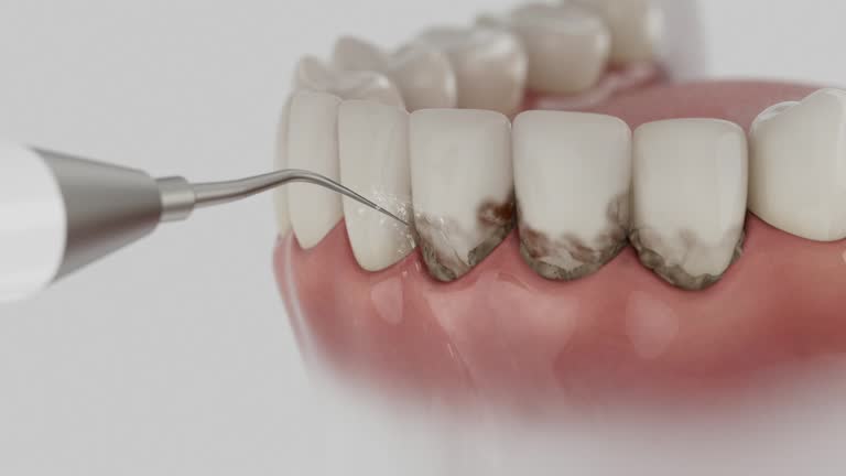 Reliable Dental Implants contractor in Graham, NC by Smile Center Dentistry